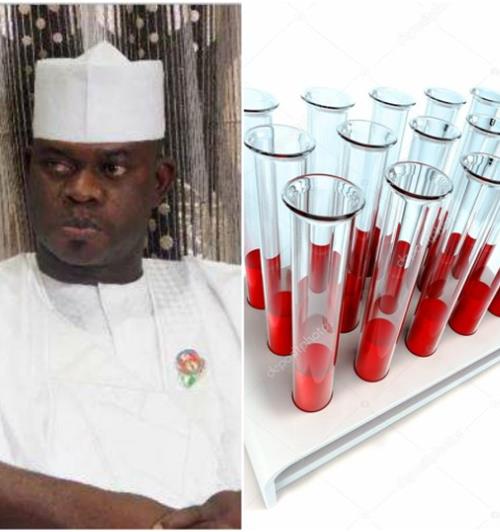Kogi State Government Reveals The Mysterious Disease That Killed 62 People