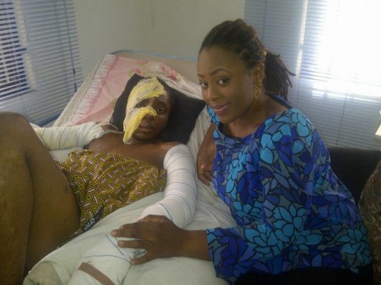 Nigerian Student Shares His Amazing Horrifying Accident Survival Story (Graphic Photos)