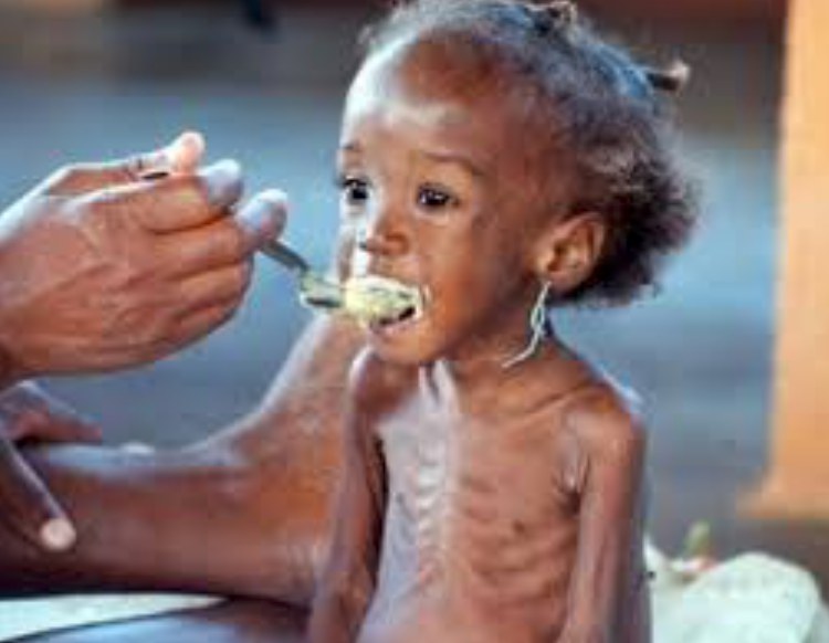 Malnourished Somalian girl in viral photo is now a beautiful student in the US...