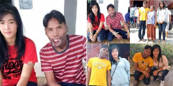 True love? Pretty 21-year-old Lady Marries Poor, Older Man With Facial Deformity (Photos)