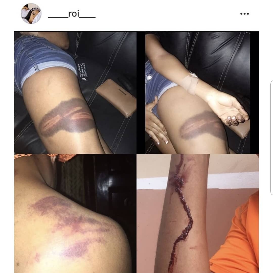 Nigerian Lady Calls Outs Her Husband For Assaulting Her And Sleeping With Their Maid