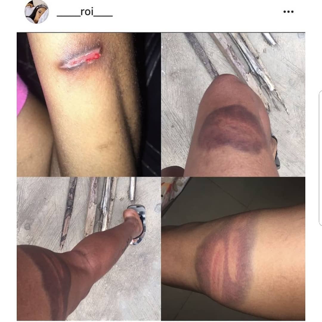 Nigerian Lady Calls Outs Her Husband For Assaulting Her And Sleeping With Their Maid