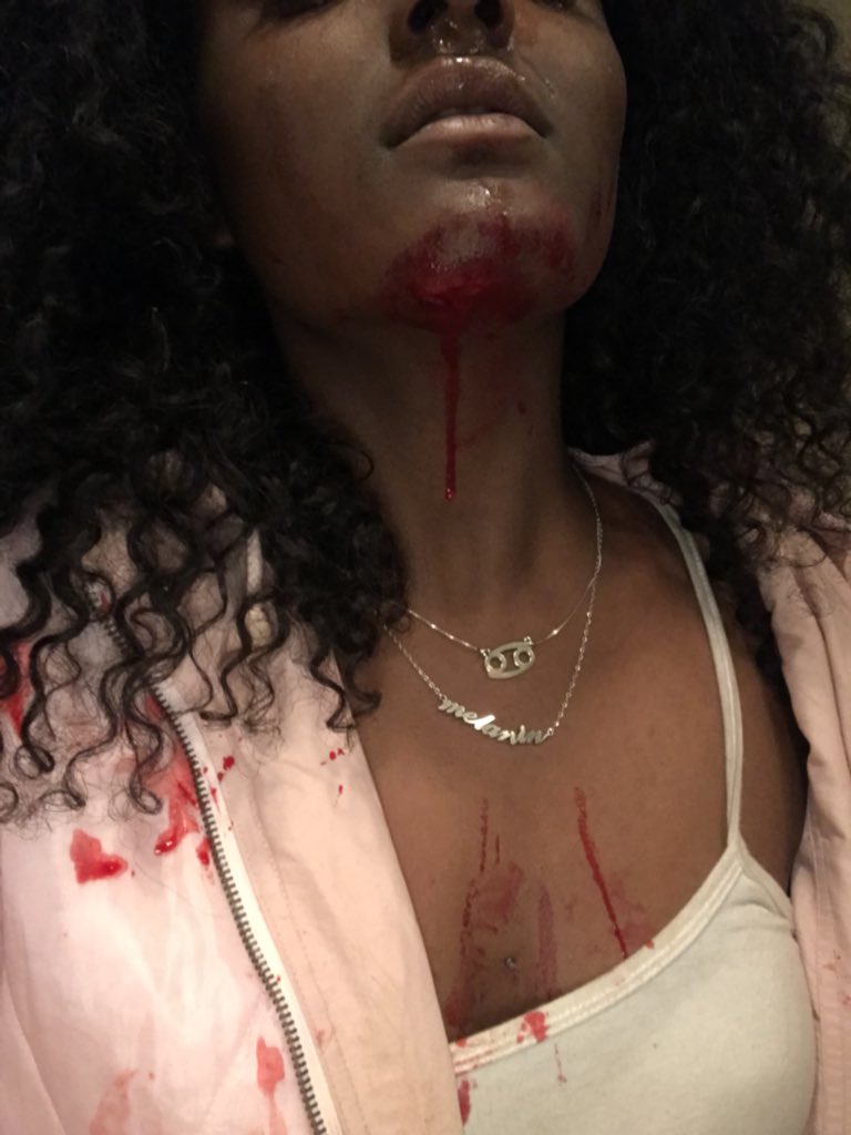 Lady shares disturbing photos of injuries she sustained through domestic violence