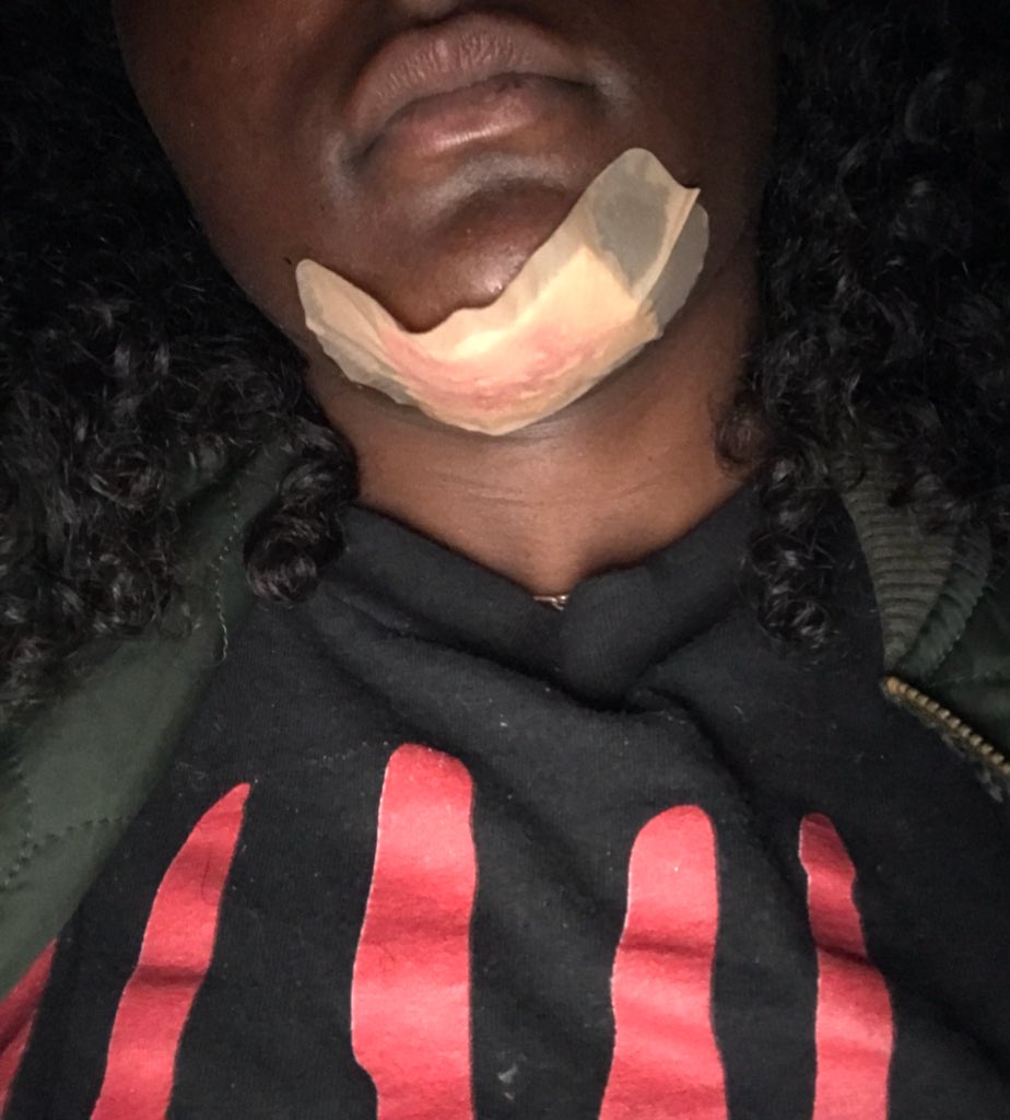 Lady shares disturbing photos of injuries she sustained through domestic violence