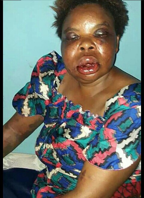 Man beats wife to a pulp following disagreement (Photos)