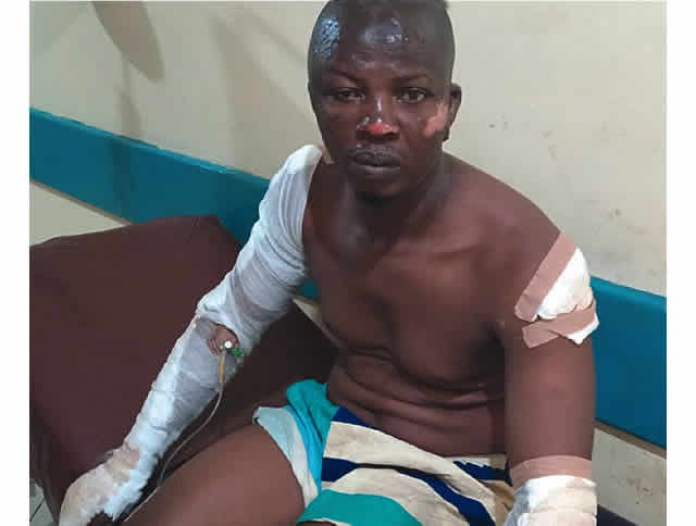 Lagos Tanker Explosion: Burn Survivors Narrate Experience
