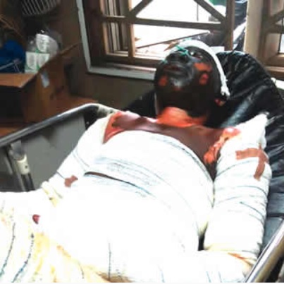 Lagos Tanker Explosion: Burn Survivors Narrate Experience