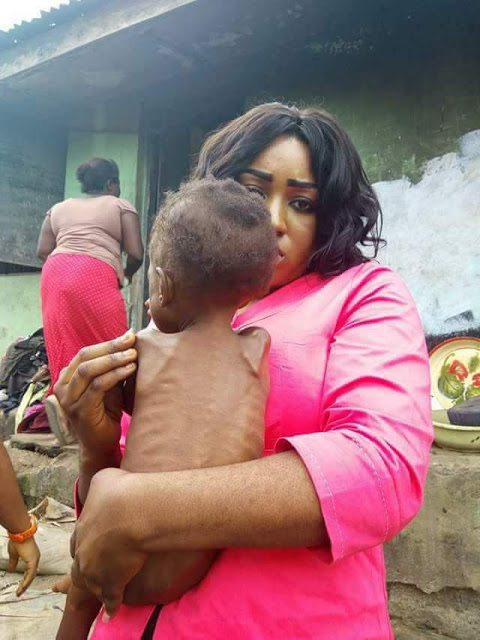 'I thought it was a small dead dog'- lady celebrates once malnourished child she rescued in Calabar as she turns 3 (Photos)