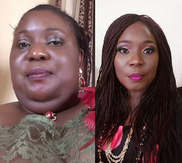 'Fat Was My Jail, My Private Personal Hell' - Comedienne, Lepacious Bose