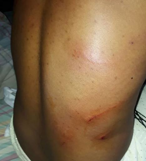 Lady calls out her uncle for brutalizing her in Abuja, shares photos
