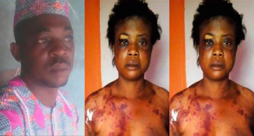 I only gave her one blow - Man arrested for beating wife over N500