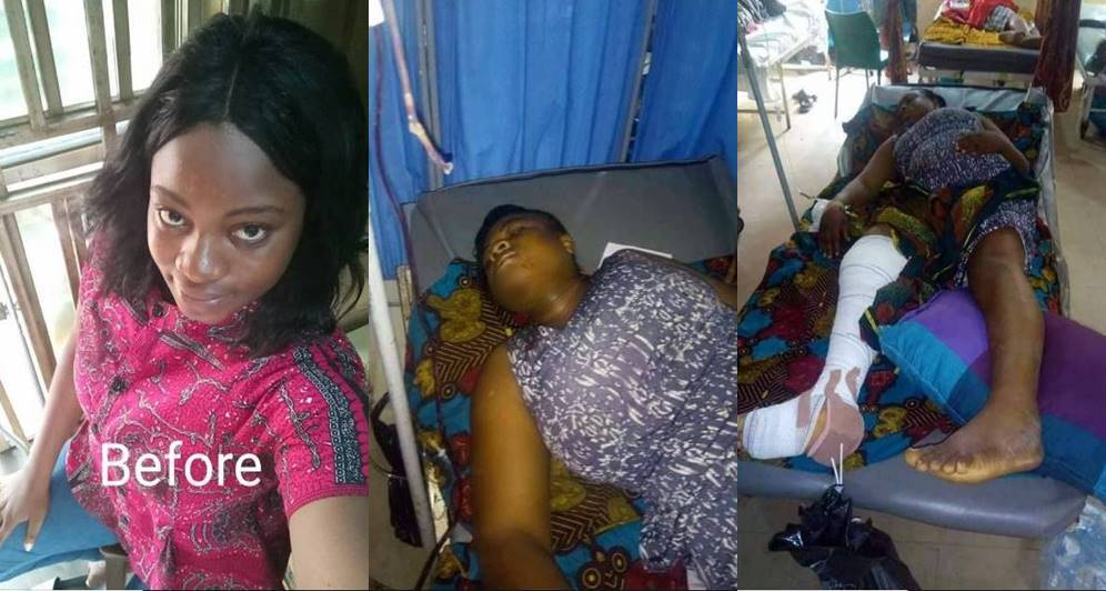 Lady Falls From Balcony Of 2-storey Building While Chatting With Friend (Photos)