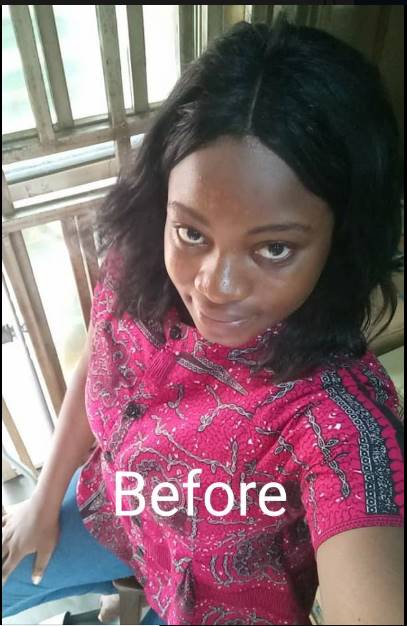 Lady Falls From Balcony Of 2-storey Building While Chatting With Friend (Photos)