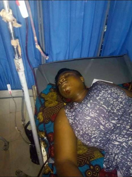 Lady Falls From Balcony Of 2-storey Building While Chatting With Friend (Photos)