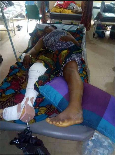 Lady Falls From Balcony Of 2-storey Building While Chatting With Friend (Photos)