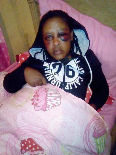 Lady dies after her boyfriend beat her up on her birthday