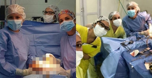 Doctors suspended for taking selfies during a surgery (Photos)