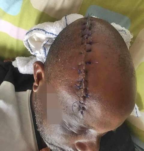 Man butchered with machete by his security guard in Oyo State, miraculously survives (Photos)