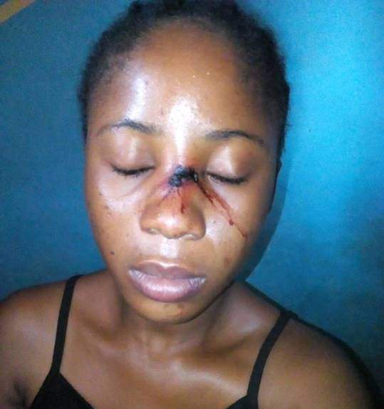 Auchi Polytechnic lecturer flees after inflicting female student with injury