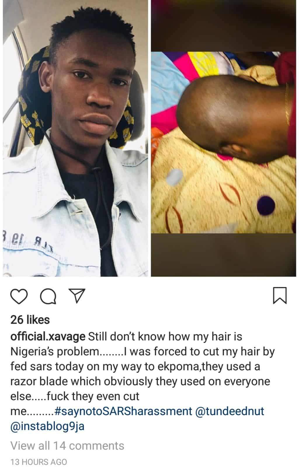 Boy reveals how officers of SARS shaved his hair with an unsterilized blade