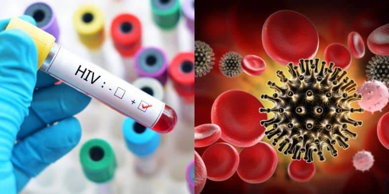 Scientists detect new strain of HIV virus