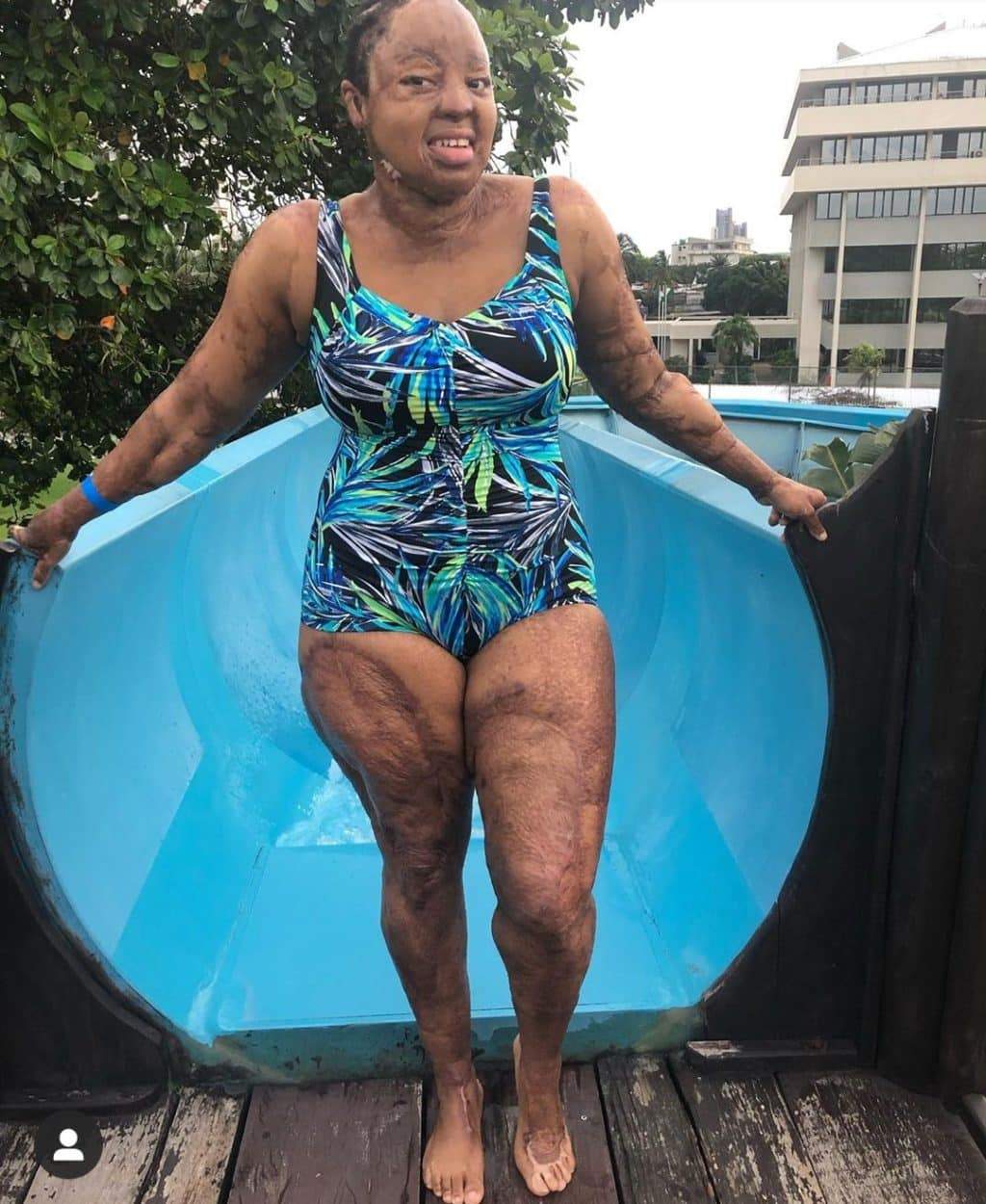 Kechi joins #AsSheIs challenge on IG with unfiltered bikini photos