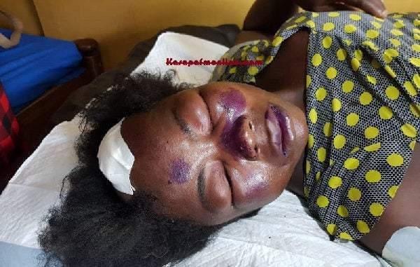 Husband beats wife into coma for sleeping with another man on their matrimonial bed