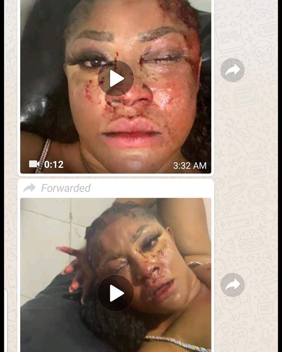 'Death is Not one of God's Blessings' - Angela Okorie speaks out after being attacked by gunmen