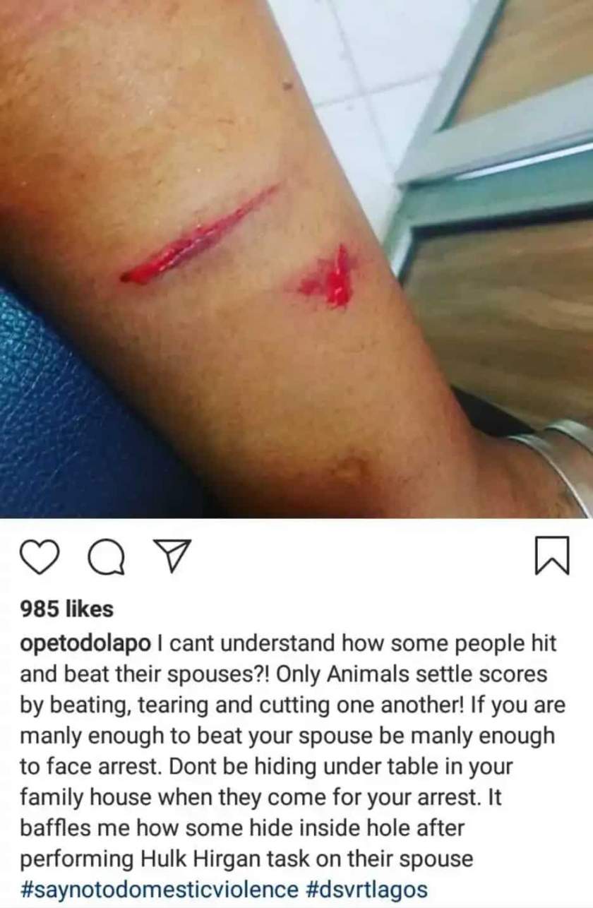'If you are man enough to beat your spouse, be man enough to face arrest' - Police PRO, Dolapo Badmos