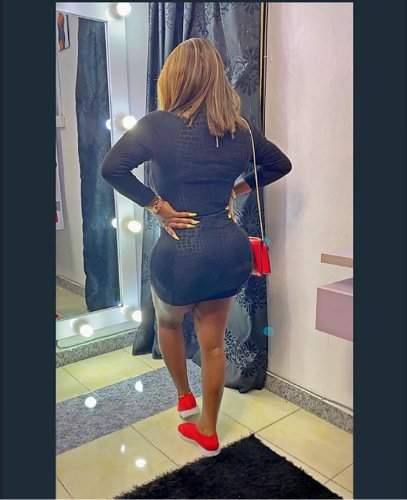 'My yansh don heal' - Omohtee displays new shape as she recovers from failed cosmetic surgery (Photos)