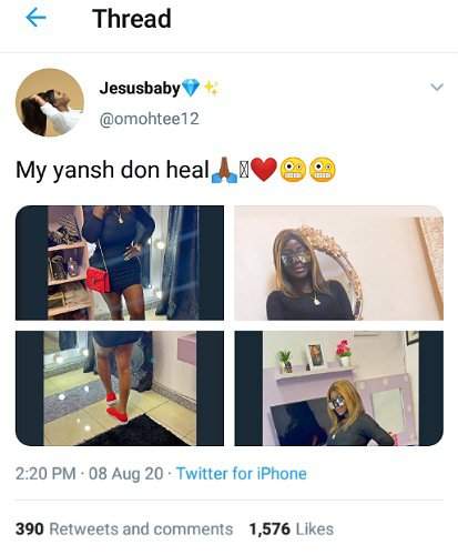 'My yansh don heal' - Omohtee displays new shape as she recovers from failed cosmetic surgery (Photos)