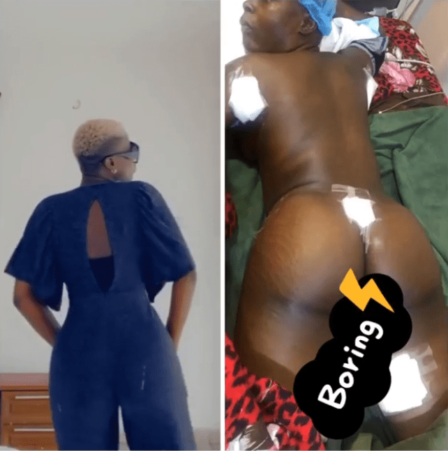 Photo of BBNaija's Khloe undergoing butt enlargement surgery surfaces online