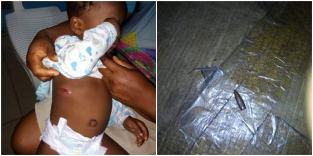 Baby nearly killed by stray bullet allegedly fired by police officer in Port Harcourt (Photos)