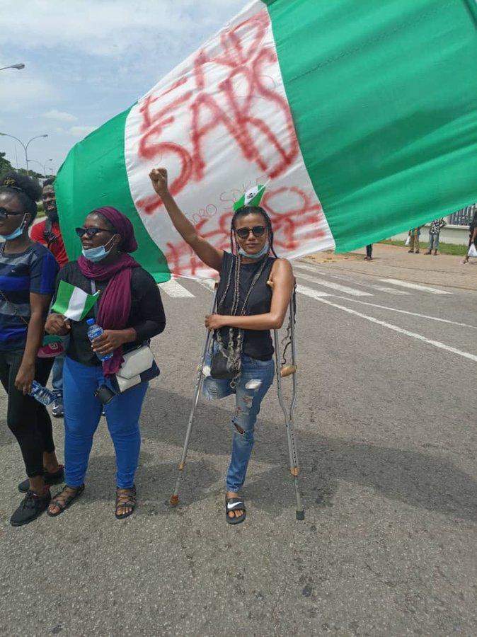 Nigerians raise over N3million to buy prosthetic leg for disabled lady who joined #EndSARS protest