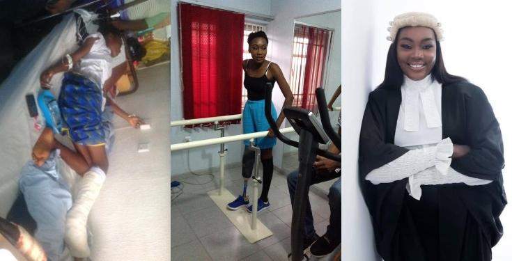 Lady lists all she achieved 5 years after losing her leg to an accident (Photos)