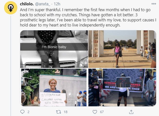 Lady lists all she achieved 5 years after losing her leg to an accident (Photos)