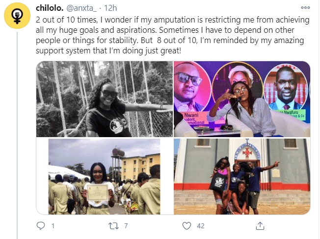 Lady lists all she achieved 5 years after losing her leg to an accident (Photos)