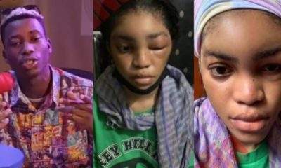 Lil Frosh denies beating girlfriend, says the swelling on her face was due to allergic reaction (Video)