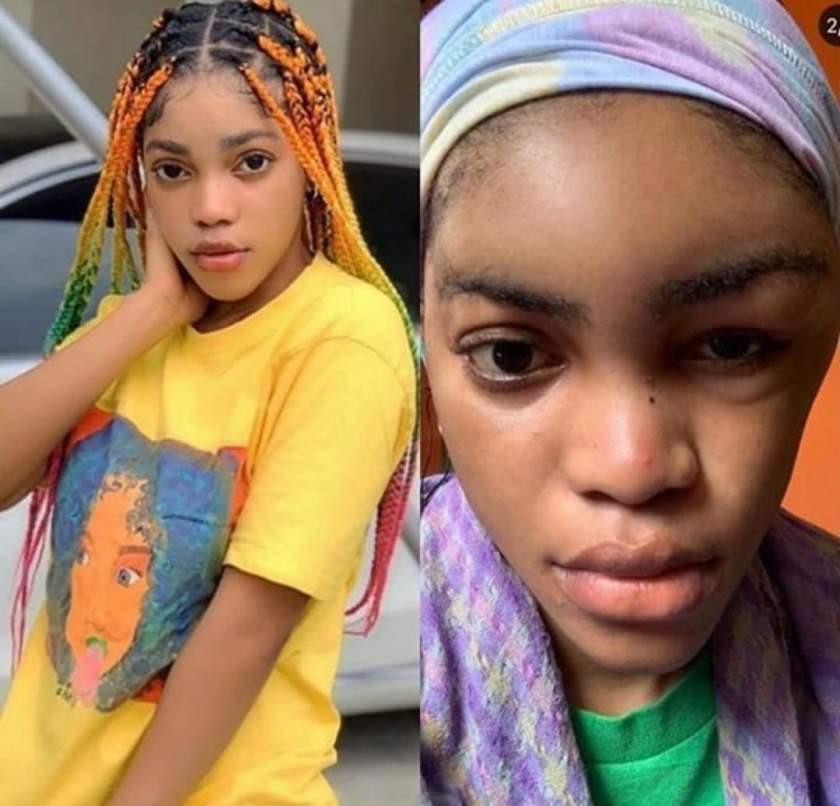 Lil Frosh's Girlfriend Reacts After He Denied Beating Her Up