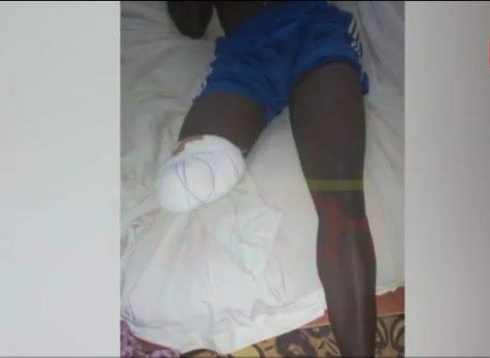 victim lekki shooting leg amputated