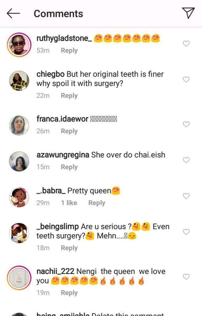 'Nothing is real about you' - Fans drag Nengi as old photo confirms she had dental surgery