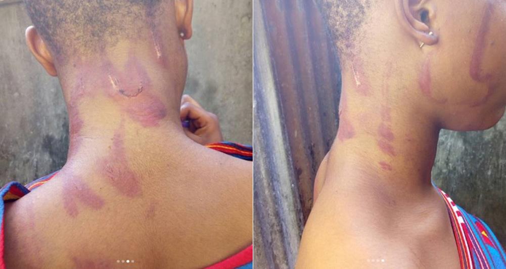 Young girl reportedly battered by her parents for not being indoors when they arrived home from work (Photos)