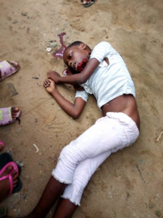 10-Year-Old Boy Killed By Stray Bullet From SARS Operative (Graphic Photos)1
