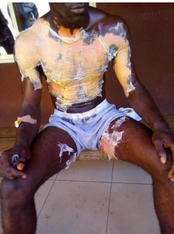 Nigerian Lady Throws Mixture Of Hot Water, Pepper And Salt On Her Male Colleague In Cross River