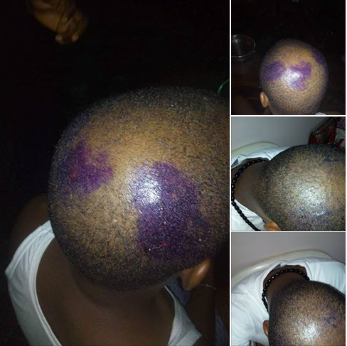 Nigerian Man Narrates How He Was Stabbed, Shot By Armed Robbers On His Way From Church