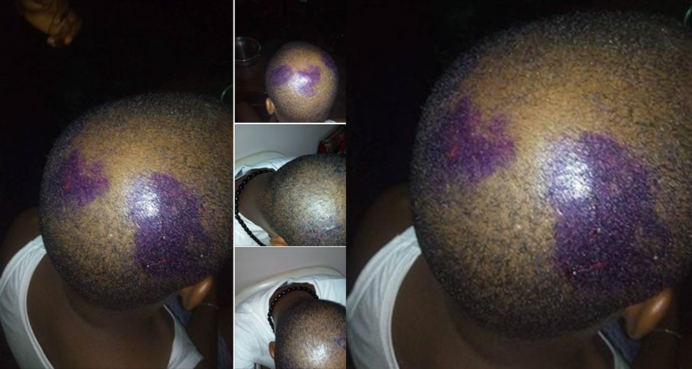 Nigerian Man Narrates How He Was Stabbed, Shot By Armed Robbers On His Way From Church