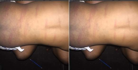 Nigerian mother seeks advice on what to do after a teacher did this to her 2-year-old daughter