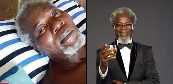 Two years after, Nigerian actor Victor Olaotan still needs money to travel abroad over possibility of his two legs being amputated