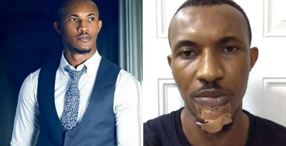 Actor, Gideon Okeke narrates how Police and LASTMA officials beat and dragged him on the ground because he asked for help (Video)