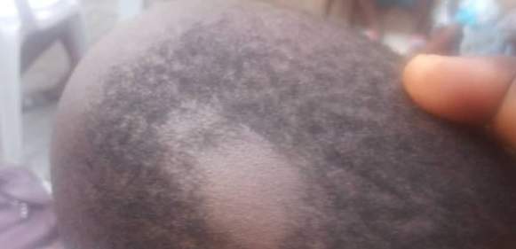 Woman Cries Out After Her Son's Hair Was Shaved Off In School And His School Fees Returned...